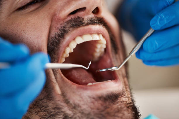Best Emergency Dental Services for Seniors in Surfside, FL